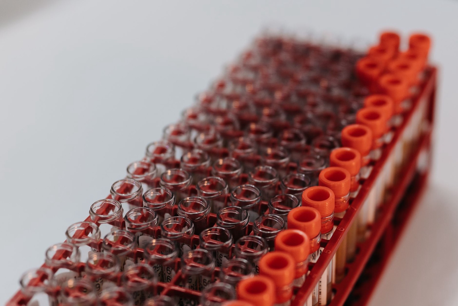 Tube de prélèvement sanguin en laboratoire, image illustrant un marqueur immunitaire mesuré après l'effort